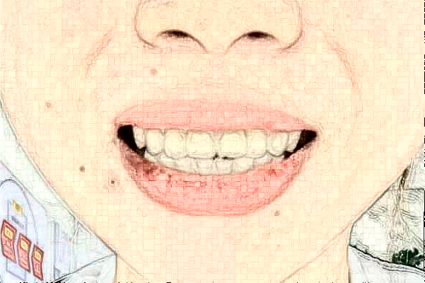 2024杭州市第一人民醫(yī)院口腔科種植牙修復(fù)價格表_醫(yī)生排名