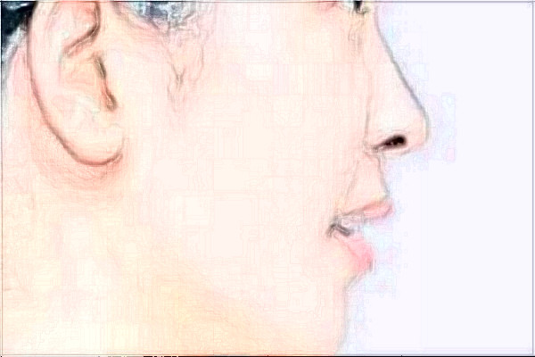 南京鼓樓醫(yī)院做的好嗎？誰做的好