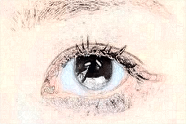 貴陽市第一人民醫(yī)院光子嫩膚好嗎?2024光子嫩膚費用