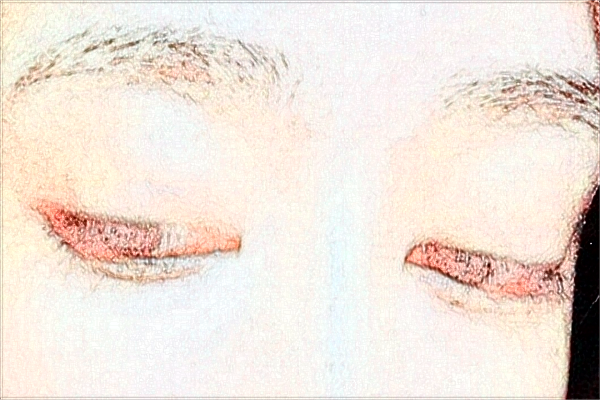 2024南京鼓樓醫(yī)院近視眼手術多少錢?醫(yī)生名單推薦