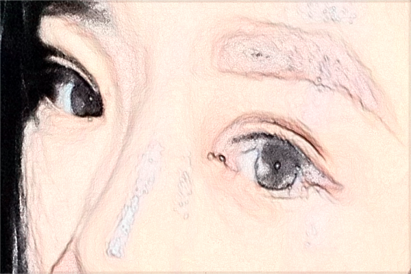 2024南京鼓樓醫(yī)院近視眼手術多少錢?醫(yī)生名單推薦