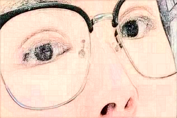 2024天津市醫(yī)科大學(xué)眼科醫(yī)院半飛秒價格多少?做的怎么樣