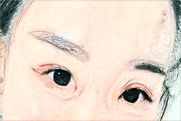 2024天津市醫(yī)科大學(xué)眼科醫(yī)院半飛秒價格多少?做的怎么樣