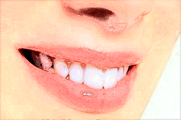 2024中山大學附屬第三醫(yī)院正畸醫(yī)生推薦?正畸多少錢