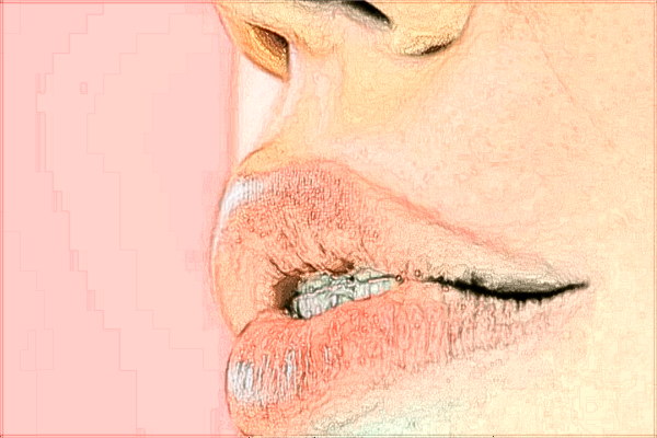 中山大學附屬第三醫(yī)院矯正視力怎么樣?2024矯正視力手術多少錢