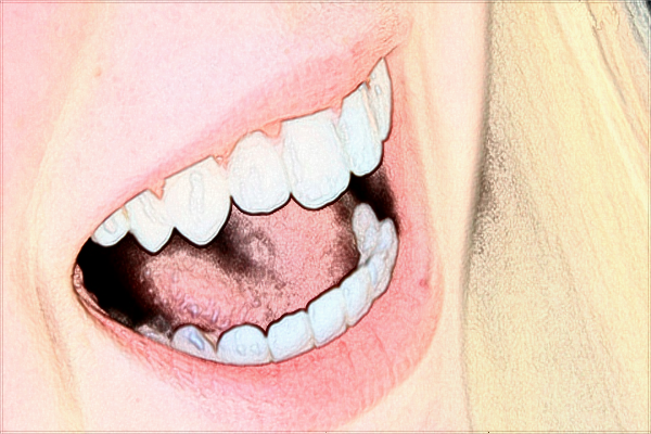 2024蘭州大學(xué)第二醫(yī)院補(bǔ)牙多少錢?補(bǔ)牙后一般能維持幾年