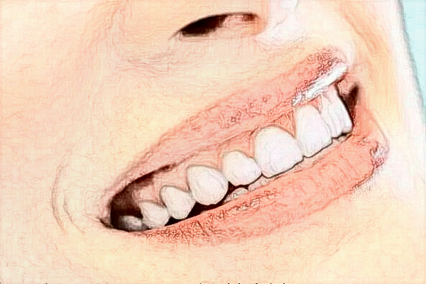 2024山東省千佛山醫(yī)院口腔科專家有哪些?專家收費(fèi)貴嗎?