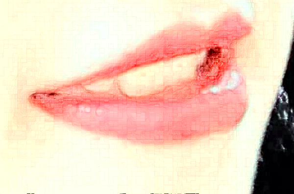 2024南京中大醫(yī)院口腔科牙體牙髓做的好嗎?