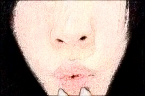 2024揚(yáng)州市第一人民醫(yī)院激光祛斑怎么樣?全新案例分享