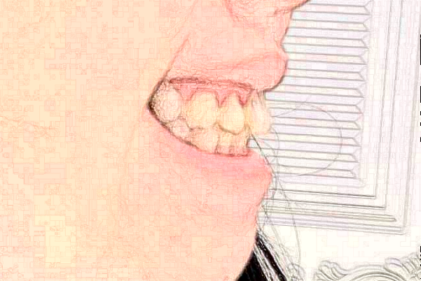 江蘇大學附屬醫(yī)院口腔科錯牙合畸形矯正怎么樣_專家名單