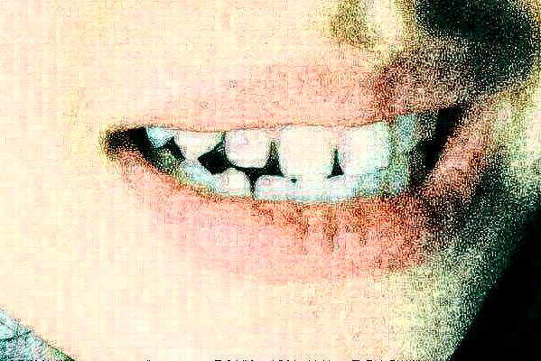 無(wú)錫市第一人民醫(yī)院口腔科全瓷牙做的怎么樣_哪位醫(yī)生做得好