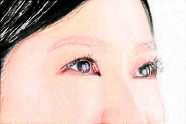 天津市醫(yī)科大學(xué)眼科醫(yī)院近視怎么樣_整形日記分享