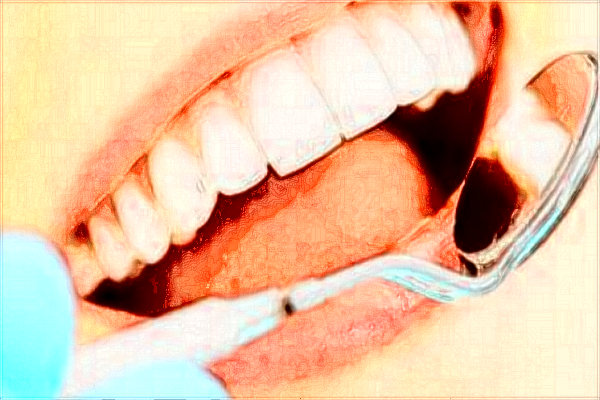 中山大學(xué)附屬第五醫(yī)院牙科怎么樣?2024牙科收費價格