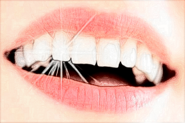 2024中山大學(xué)附屬口腔醫(yī)院植牙價(jià)格?植牙后注意事項(xiàng)