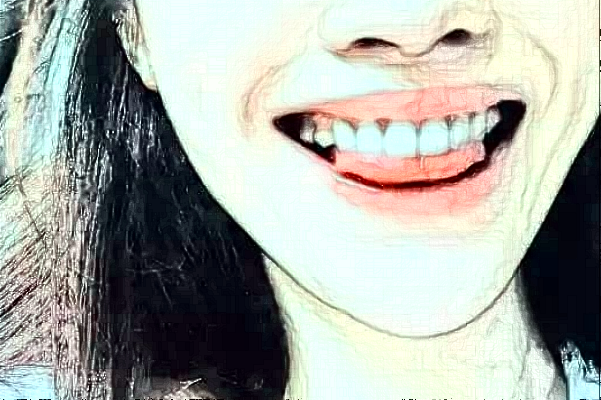 江蘇省人民醫(yī)院活動義齒修復做的好嗎【真實案例分享】