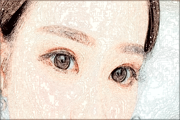 珠海市人民醫(yī)院做近視眼手術(shù)怎么掛號?近視眼手術(shù)費(fèi)用多少