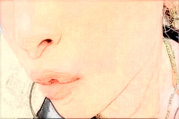 安徽省立醫(yī)院去疤痕做的好嗎?整形日記分享