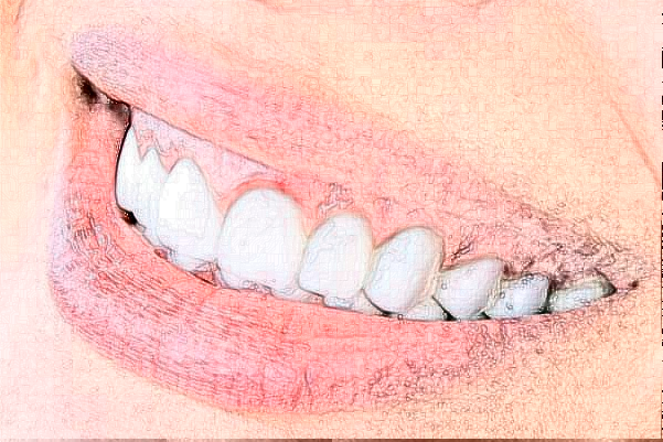 2024無錫市第一人民醫(yī)院種植牙價(jià)格表發(fā)布_醫(yī)生簡(jiǎn)介+案例