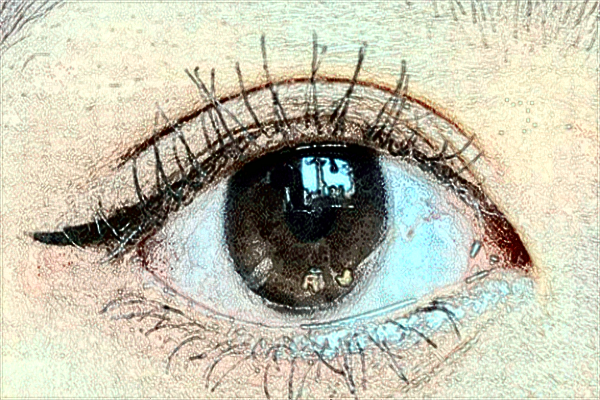 2024蘭州大學第二醫(yī)院飛秒價格?飛秒手術(shù)有什么風險