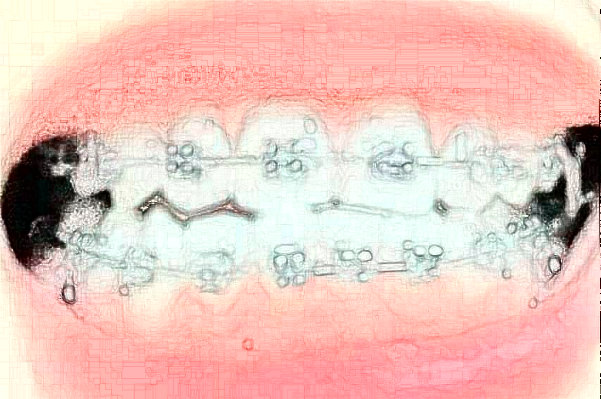 大慶市人民醫(yī)院口腔科牙齒矯正技術好嗎?醫(yī)生介紹