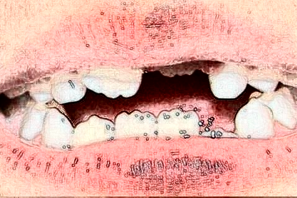 大慶市人民醫(yī)院口腔科牙齒矯正技術好嗎?醫(yī)生介紹