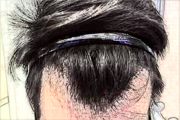 2024無(wú)錫市第一人民醫(yī)院植發(fā)怎么樣_醫(yī)生名單推薦