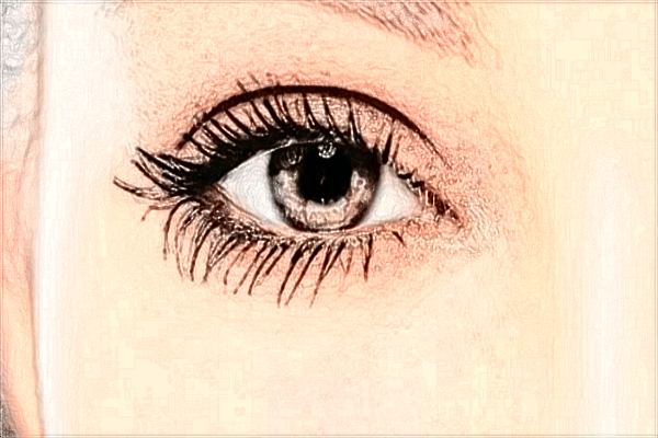 2024佛山市第二人民醫(yī)院去眼袋手術費用?去眼袋恢復期多久