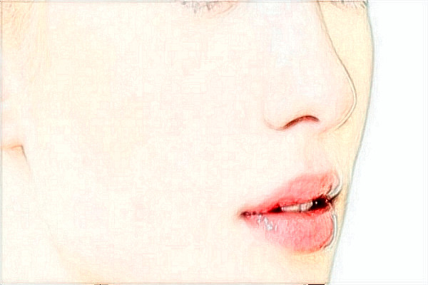 無錫市第一人民醫(yī)院激光祛斑做的怎么樣【激光祛斑全新案例】