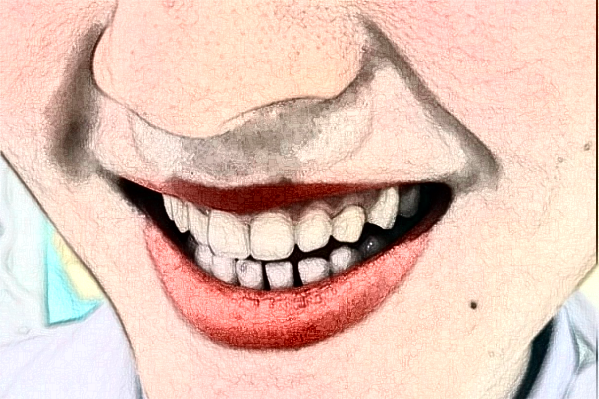 無錫市第一人民醫(yī)院口腔科鑲牙怎么樣_醫(yī)生名單推薦