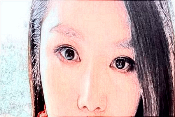 天津醫(yī)科大學(xué)總醫(yī)院熱瑪吉需要多少錢(qián)?醫(yī)生推薦