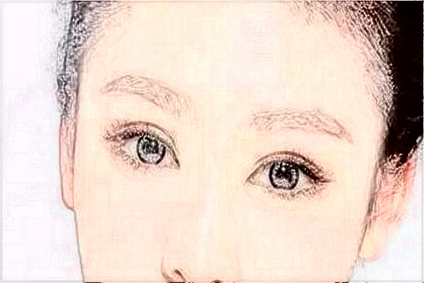 安徽省立醫(yī)院祛斑做的好嗎?整形日記分享