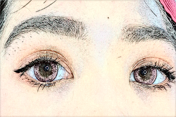 2024無錫市第一人民醫(yī)院激光去紋眉做的可以嗎？