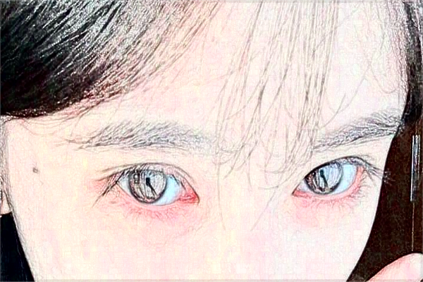 2024無錫市第一人民醫(yī)院激光去紋眉做的可以嗎？