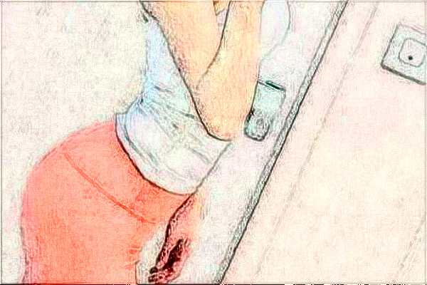 大連醫(yī)科大學附屬第一醫(yī)院吸脂做的好嗎?整形日記分享