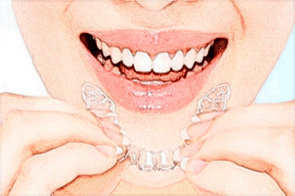 2024珠海市人民醫(yī)院正畸價格?正畸托槽好嗎?