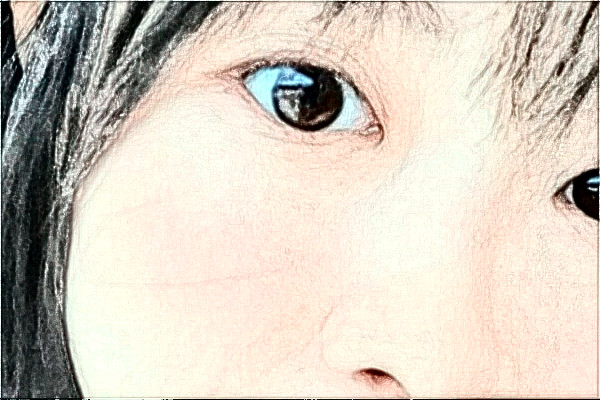 南通大學(xué)附屬醫(yī)院光子嫩膚多少錢?醫(yī)生名單推薦