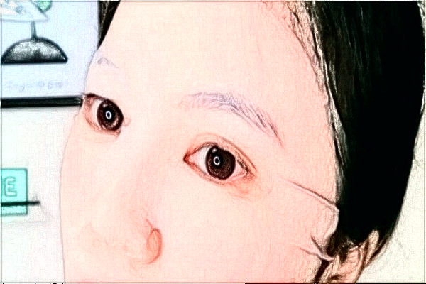 南通大學(xué)附屬醫(yī)院光子嫩膚多少錢?醫(yī)生名單推薦