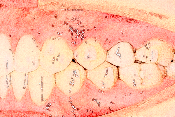 揚(yáng)州市第一人民醫(yī)院牙列不齊矯正醫(yī)生排名_口碑+價格