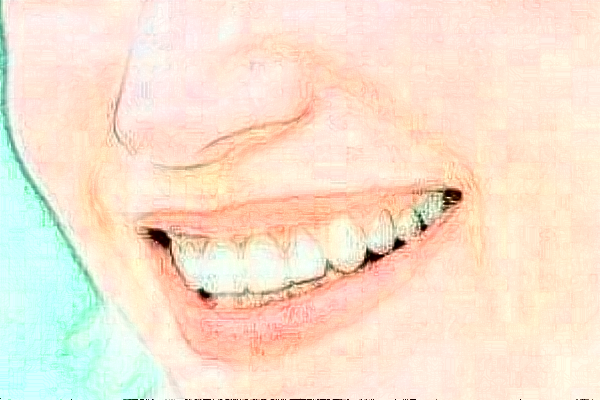 延邊醫(yī)院牙齒美白怎么樣?全新案例分享