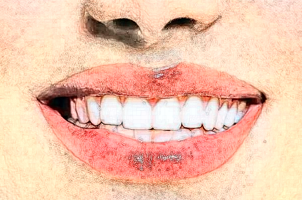 大慶市人民醫(yī)院口腔科隱形矯正價格多少?做的怎么樣