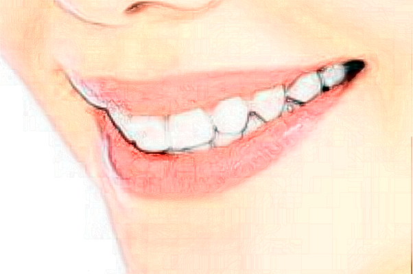 鎮(zhèn)江江濱醫(yī)院義齒修復(fù)價目表(價格表)怎么樣