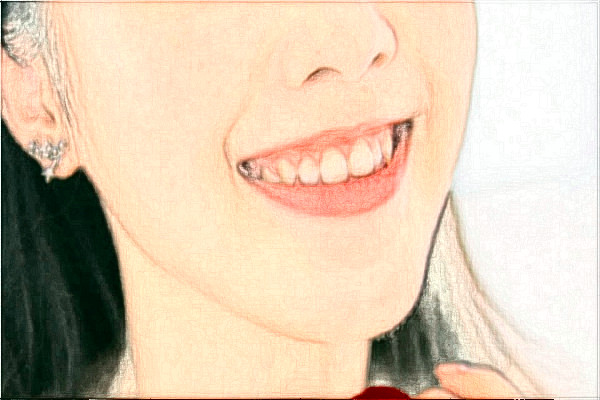 2024青島市立醫(yī)院激光祛斑要多少錢?激光祛斑好不好?