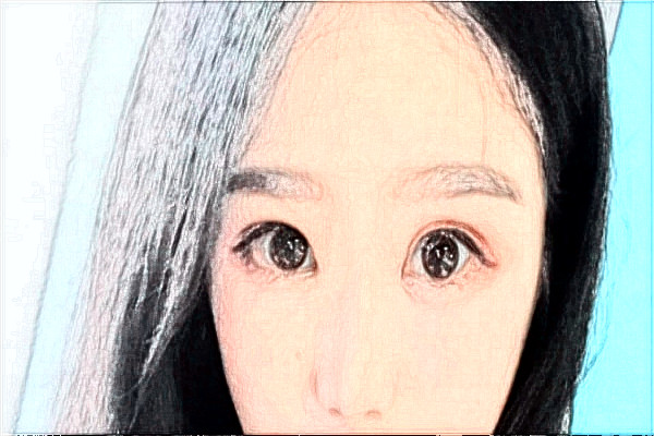 株洲市中心醫(yī)院激光近視手術(shù)怎么樣?2024全飛秒貴嗎?