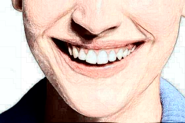 2024沈陽盛京醫(yī)院牙列擁擠矯正多少錢?做得好嗎