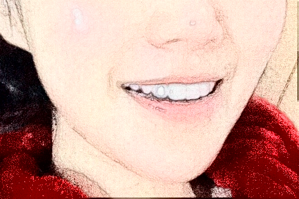 2024蘇州康美美容醫(yī)院鑲牙怎么樣_誰做得好