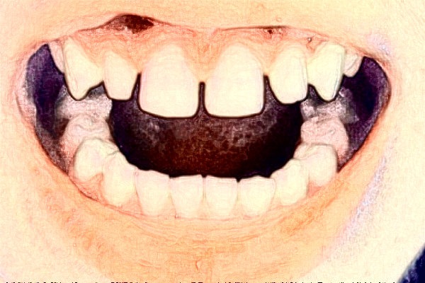 上海華美醫(yī)療美容醫(yī)院牙齒矯正哪個(gè)醫(yī)生好_專家介紹