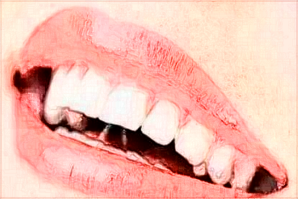 2024?？谑腥嗣襻t(yī)院補牙縫收費標準?補牙醫(yī)生