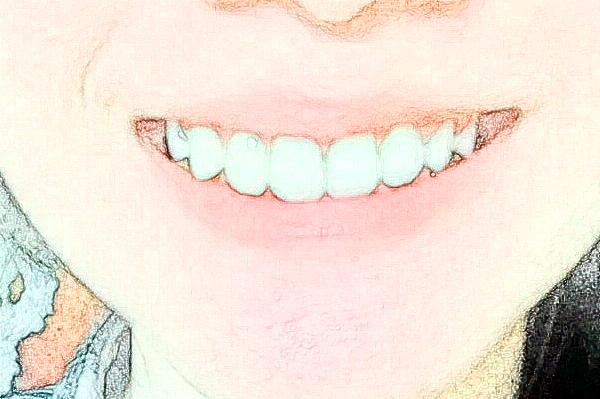 懷化市第一人民醫(yī)院牙科陳武平好嗎?牙科收費怎么樣