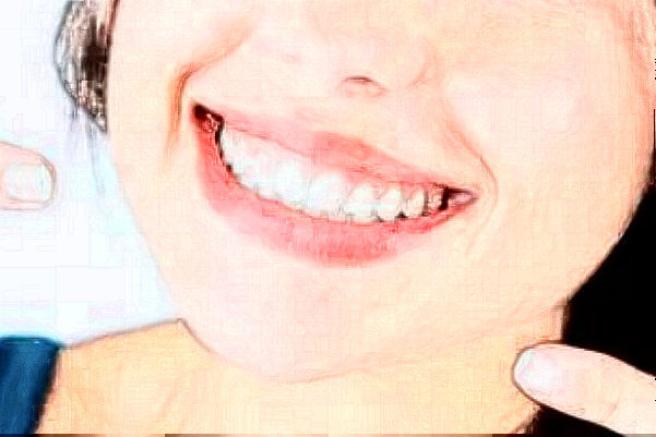 中山大學(xué)附屬口腔醫(yī)院補(bǔ)牙怎么樣?補(bǔ)牙醫(yī)生推薦名單