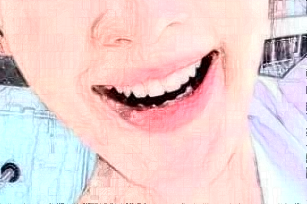 2024襄陽(yáng)新德恩口腔門診部隱形矯正怎么樣_誰(shuí)做得好